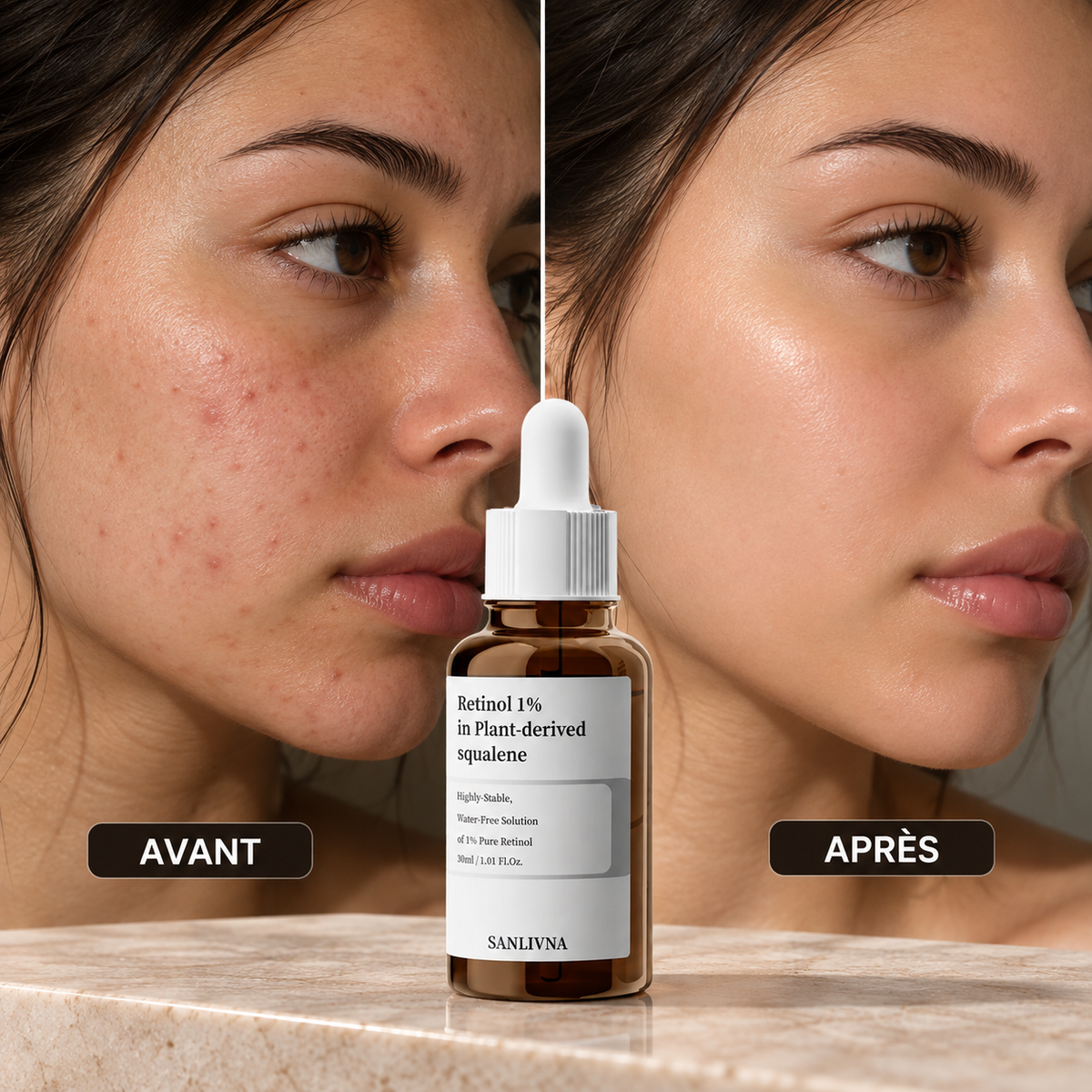 Huile-Sérum au Squalane – Confort & Nutrition